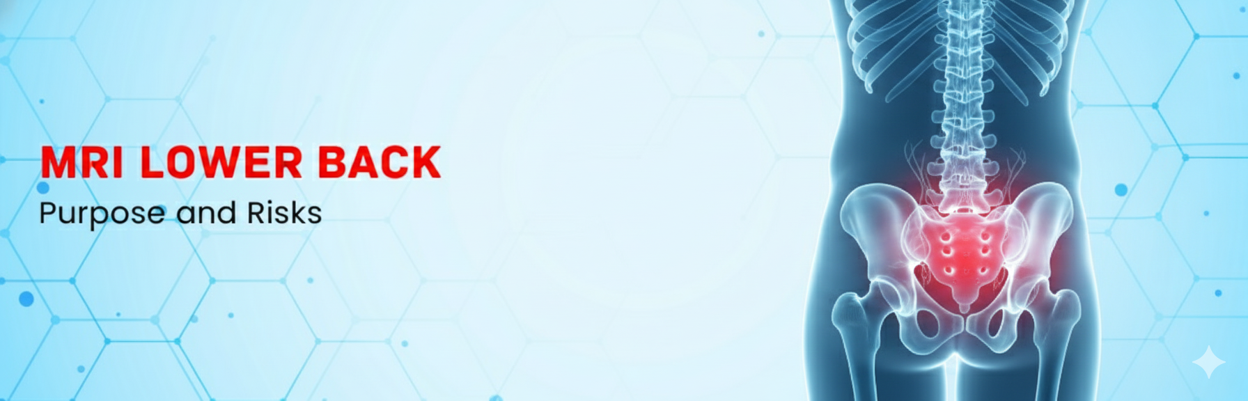  What is MRI KUB with Contrast?